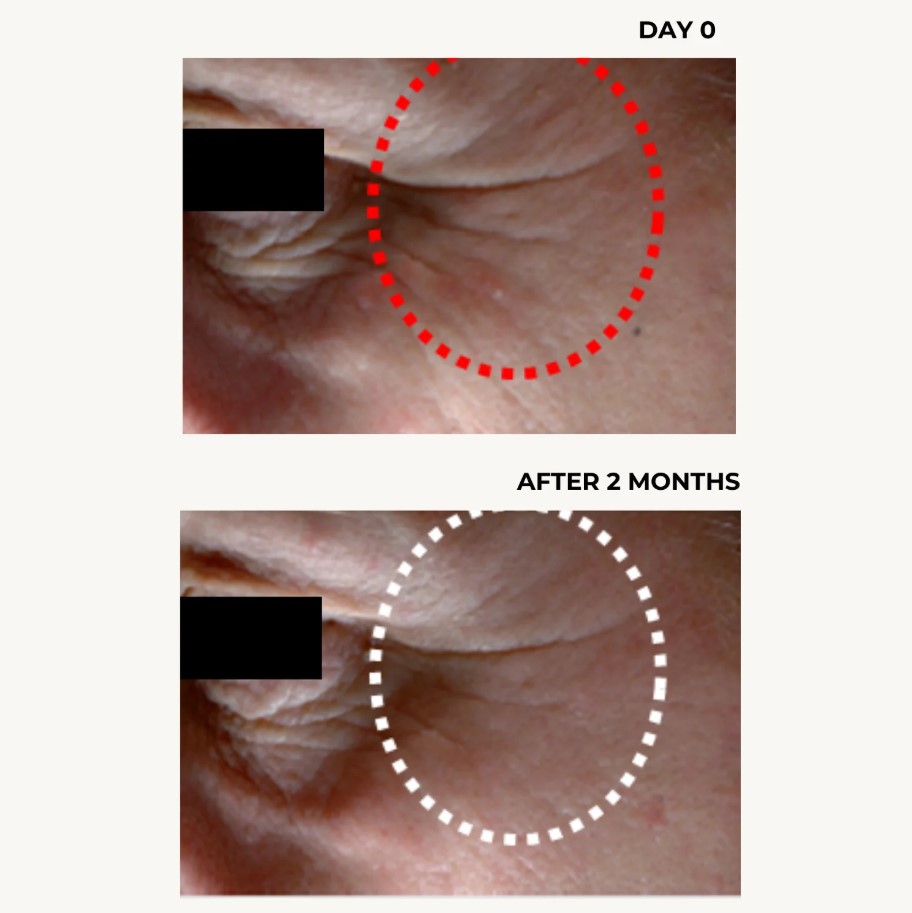 Kem dưỡng mắt, giảm quầng thâm DermEden Night Protocole Intense Eye Contour 15ml