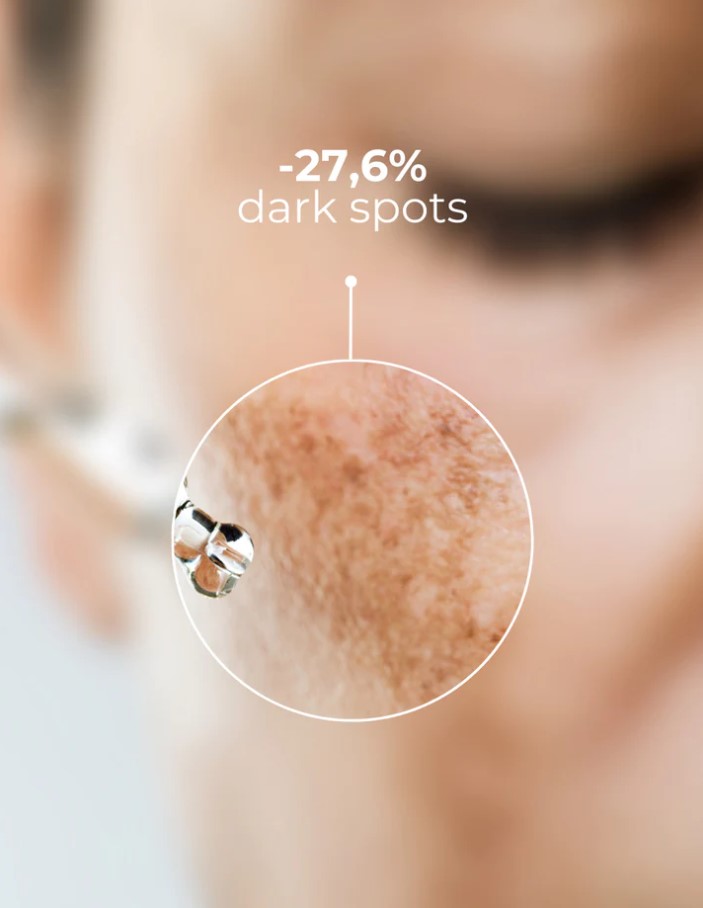 Tinh chất trị nám, giảm tàn nhang DermEden Concentrate Anti-Taches Dark Spots