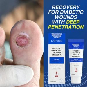 Lavior diabetic hydrogel wound dressing